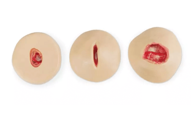 Übungsmodelle für die Vakuum - Wundtherapie - Erler - Zimmer